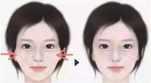北京卓艺医疗美容诊所重视技术交流与发展