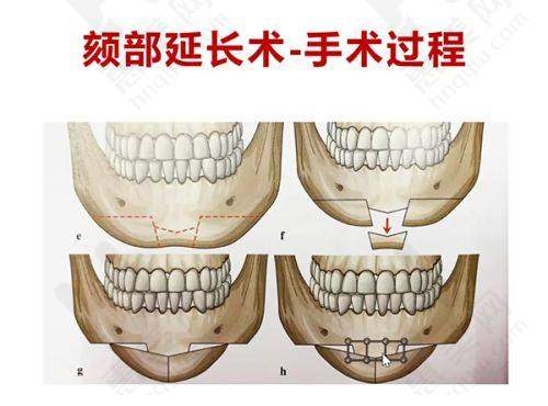 北京美玉颜医疗美容门诊部预约方式多样