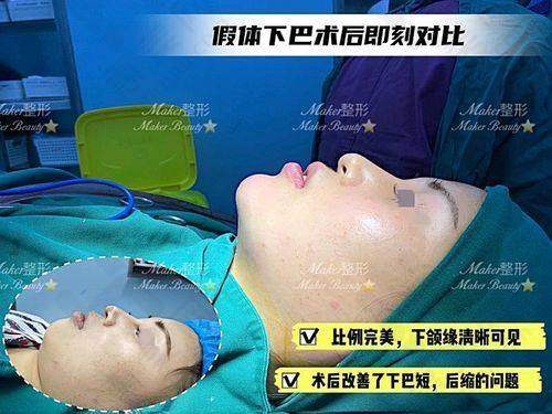 佛山亚韩整形美容门诊部的吸脂减肥骨干医生