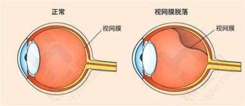 上海医大医院眼科价格与活动实惠