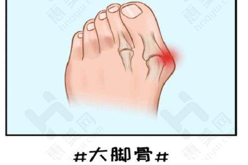 小拉皮项目引领技术升级