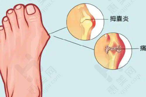 医疗保险报销情况清晰