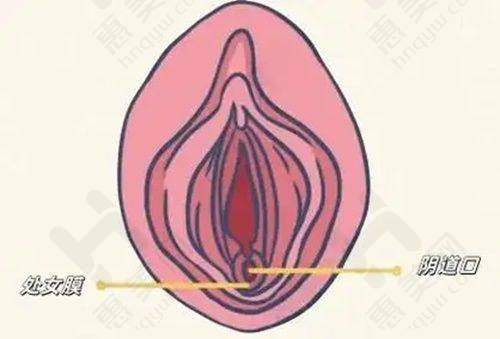 激光祛黑眼圈实例成效显著
