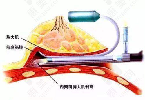 价格合理且预约便捷