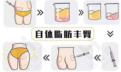 特色项目突出,脂肪填充成效好