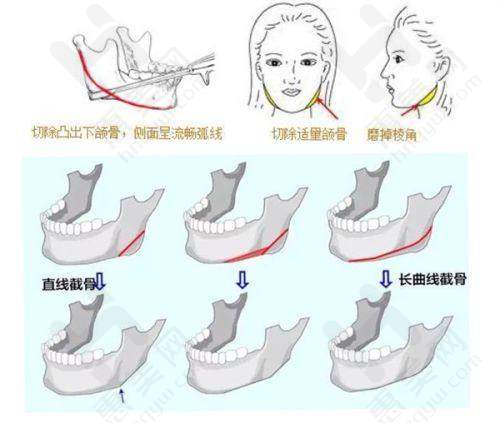 擅长项目丰富多元