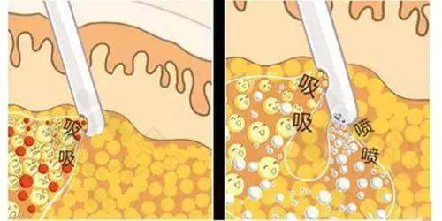 部分人群需谨慎选择