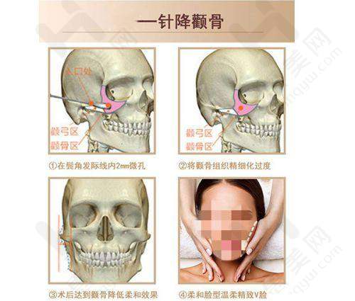 具有影响力认证与连锁优势显著