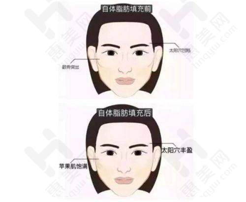 富贵包治疗成效显著