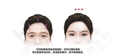 具有影响力团队技术雄厚
