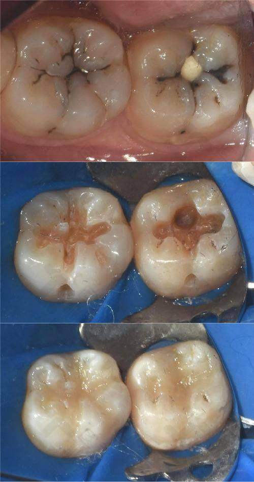 维尔口腔：就诊注意事项