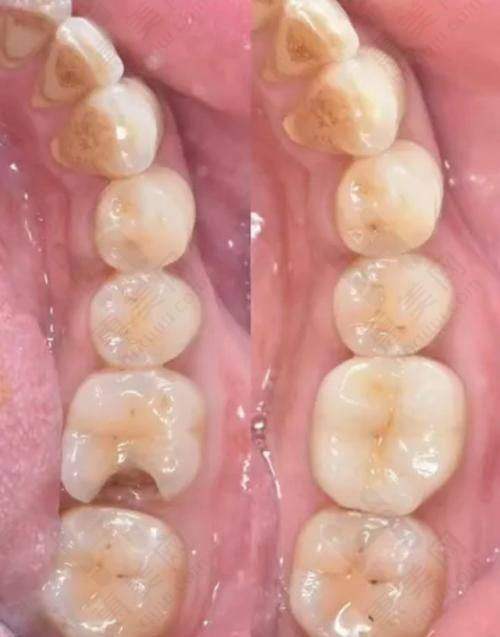 北京维尔口腔：多渠道查询与特色分院
