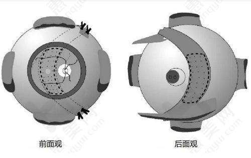 王海燕医生:眼表及屈光手术的行家