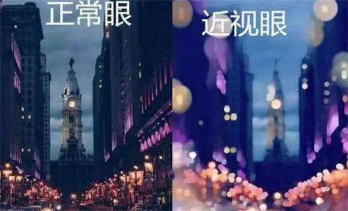 合理的近视手术价格