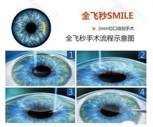 避坑指南超实用