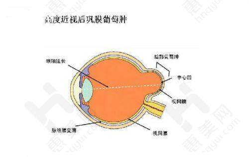 深圳市第二人民医院眼科预约挂号方式