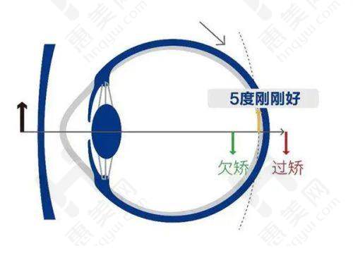 全方面的眼科诊疗服务