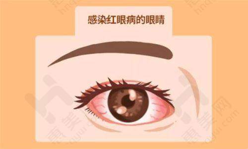 多样眼科手术价格