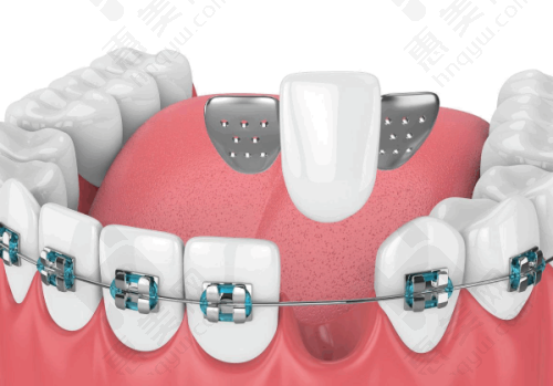 其他优势不容忽视