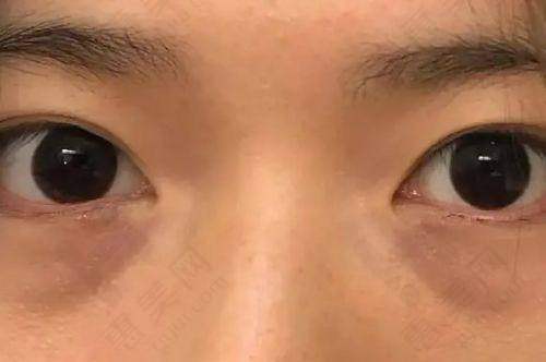 成都华美紫馨整形医院资质实力强