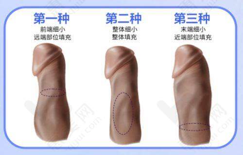 医院影响力体现