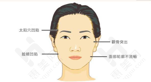医院服务质量