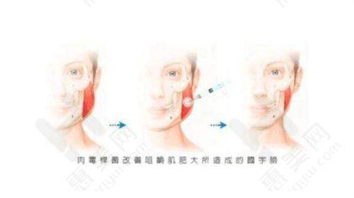 良好口碑赢得患者信赖