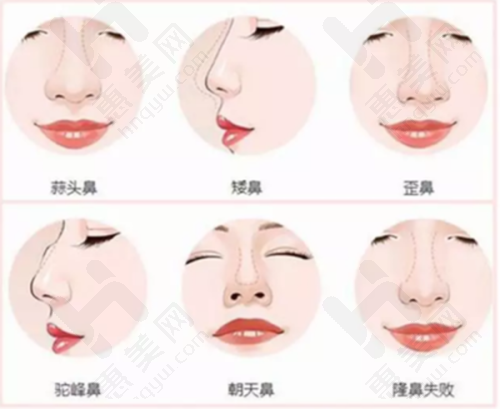 良好口碑赢得广泛认可