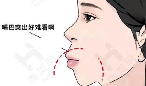 UDCO数字化正畸技术科学精细