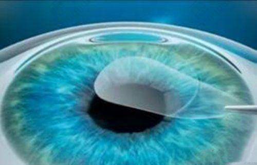 医疗保险报销范围 - 不可报销项目