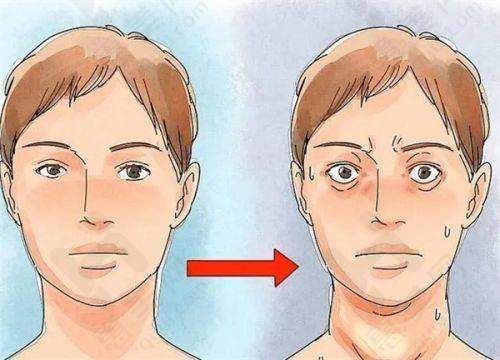 报销比例与支付流程 - 报销比例